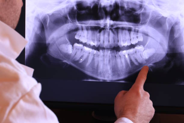 Best Emergency Treatment for Dental Infections or Abscesses in South Gull Lake, MI